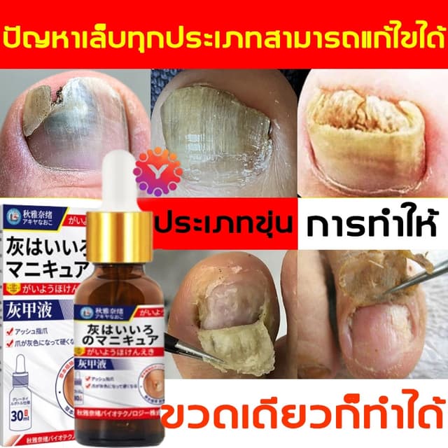 เห็นผลภายใน7วัน🔥เซรั่มบำรุงเล็บ ครีมซ่อมเล็บ ช่วยให้เล็บกลั