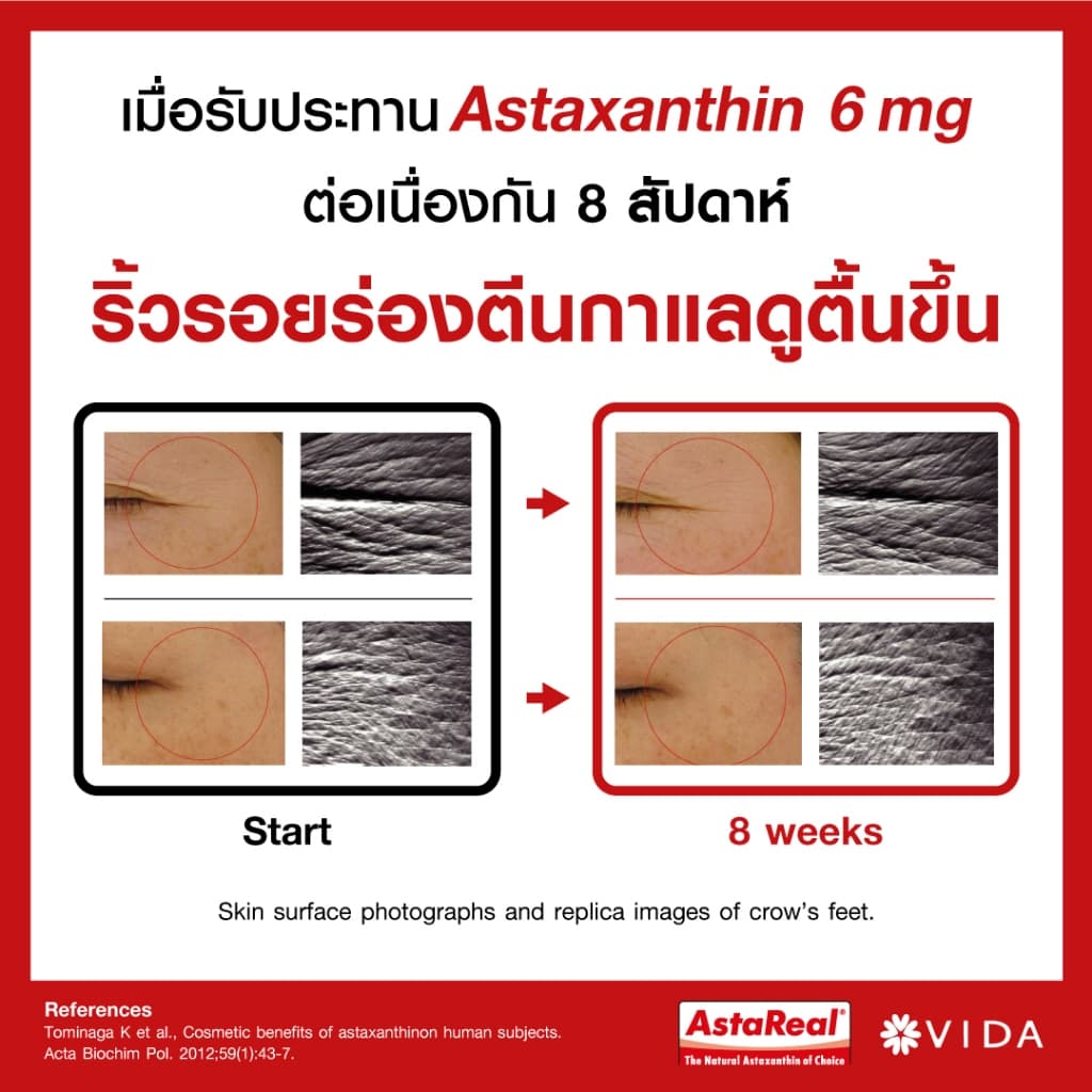 Vida Astaxanthin 6 mg Q10 AstaReal (วีด้า แอสต้าแซนธิน คิวเท็น 30 แคปซูล) สาหร่ายแดง แอสตาแซนธิน สาหร่ายฮีมาโตค็อกคัส Haematococcus https://lnwchill.com