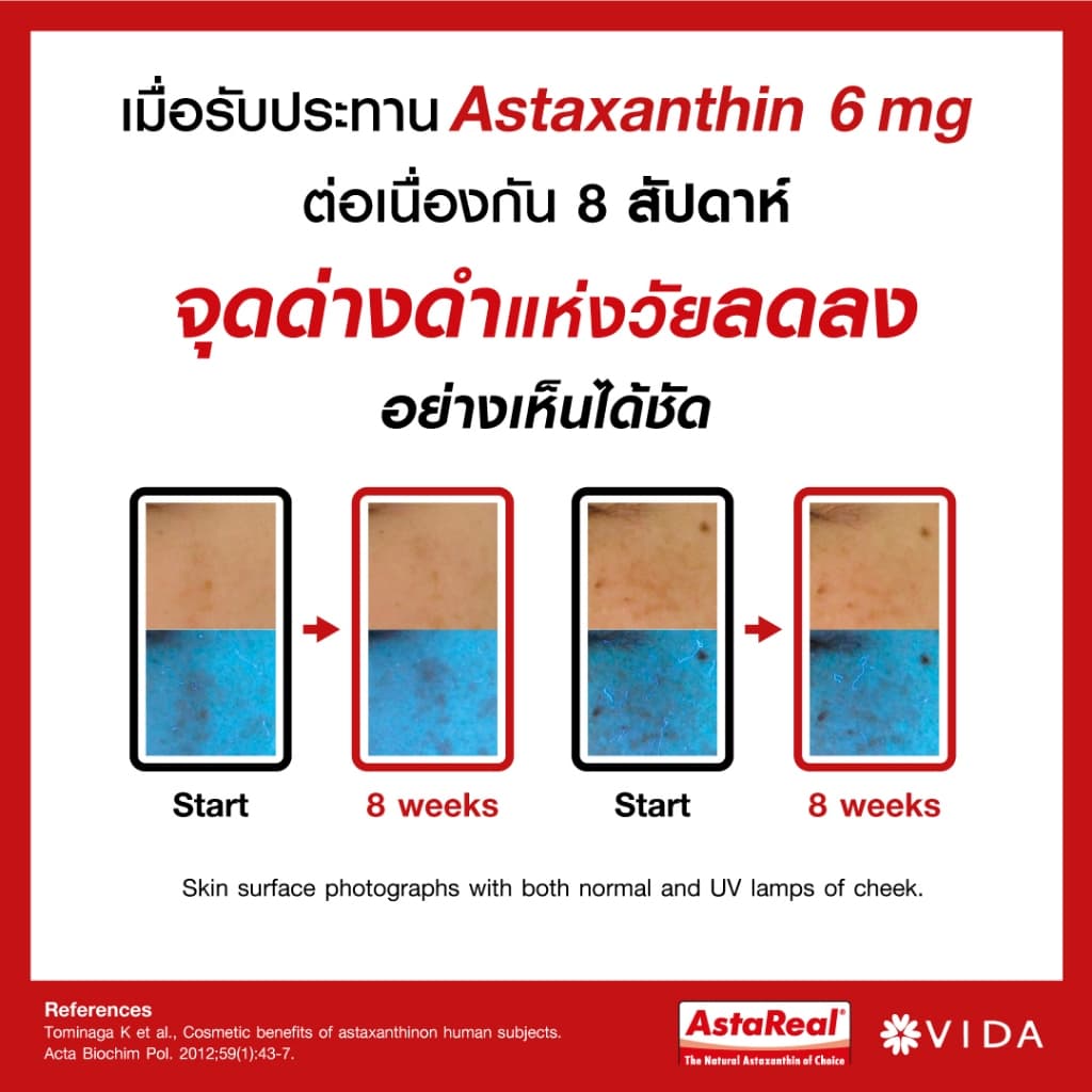 Vida Astaxanthin 6 mg Q10 AstaReal (วีด้า แอสต้าแซนธิน คิวเท็น 30 แคปซูล) (x4 กระปุก) สาหร่ายสีแดง สาหร่ายฮีมาโตค็อกคัส พลูวิเอลิส Haematococcus https://lnwchill.com