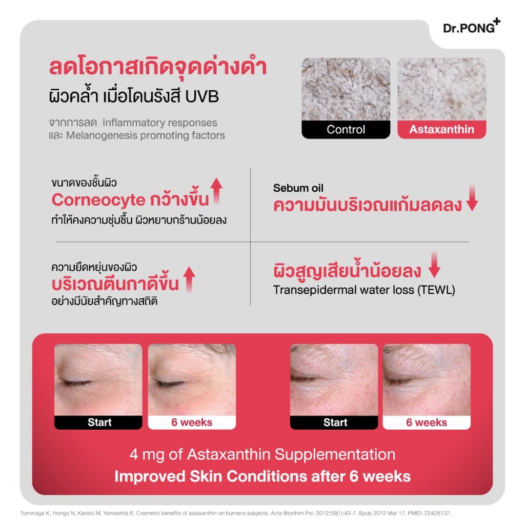 Dr.PONG Astaxanthin 6 mg. AstaREAL แอสตาแซนธิน ดอกเตอร์พงศ์ เนเชอรัล แอสตาแซนธิน 6 มก. https://lnwchill.com