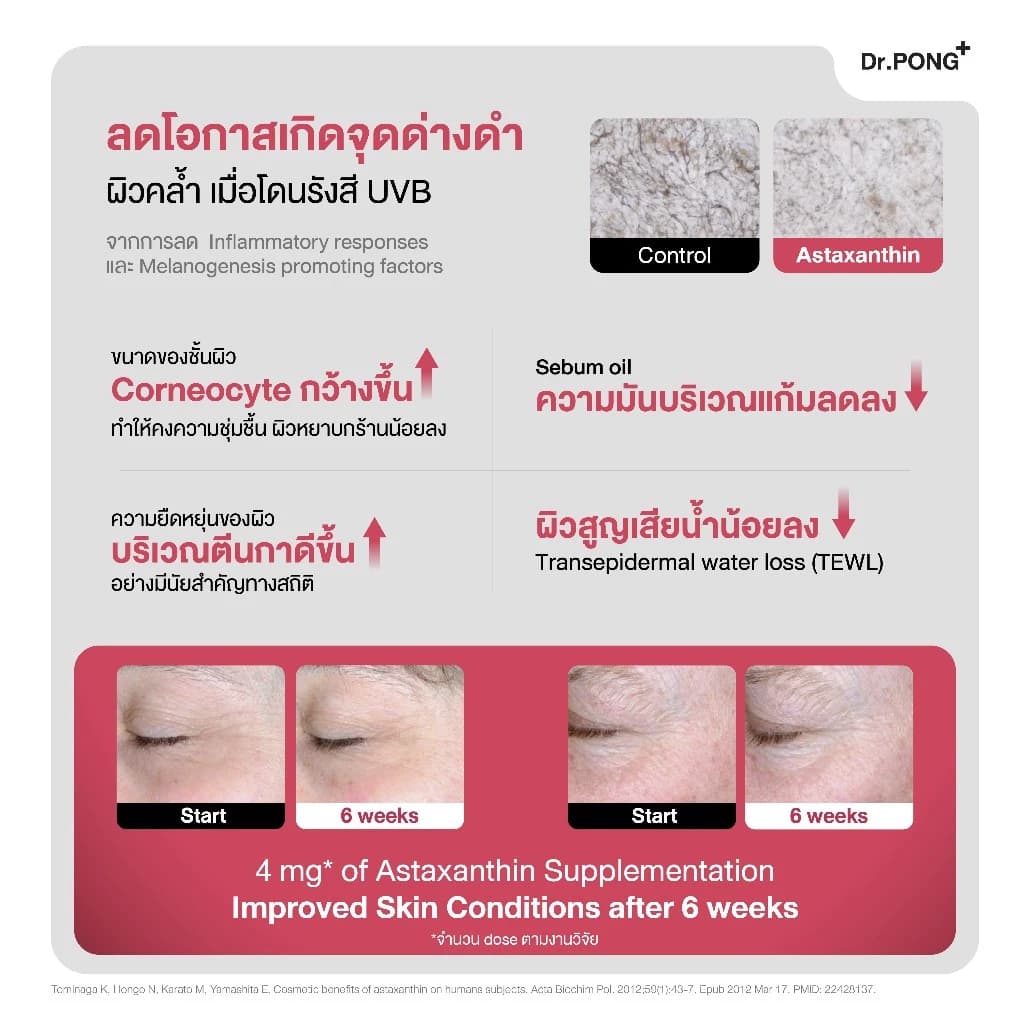 Dr.PONG Astaxanthin 6 mg. AstaREAL แอสตาแซนธิน ดอกเตอร์พงศ์ เนเชอรัล แอสตาแซนธิน 6 มก. https://lnwchill.com